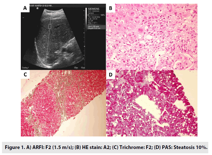 imaging-in-medicine-Trichrome