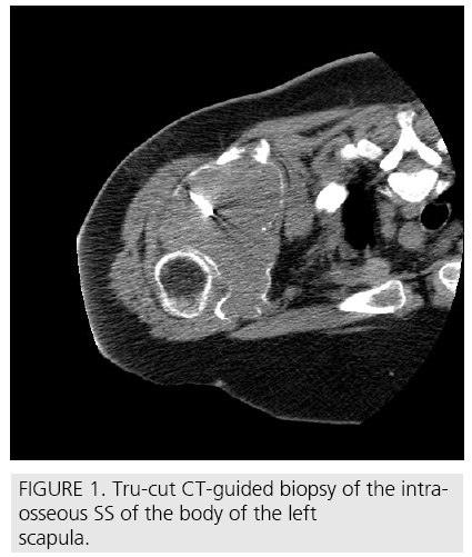 imaging-in-medicine-Tru-cut