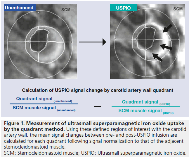 imaging-in-medicine-Ultrasmall-superparamagnetic