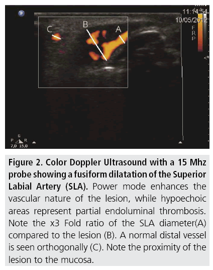 imaging-in-medicine-Ultrasound