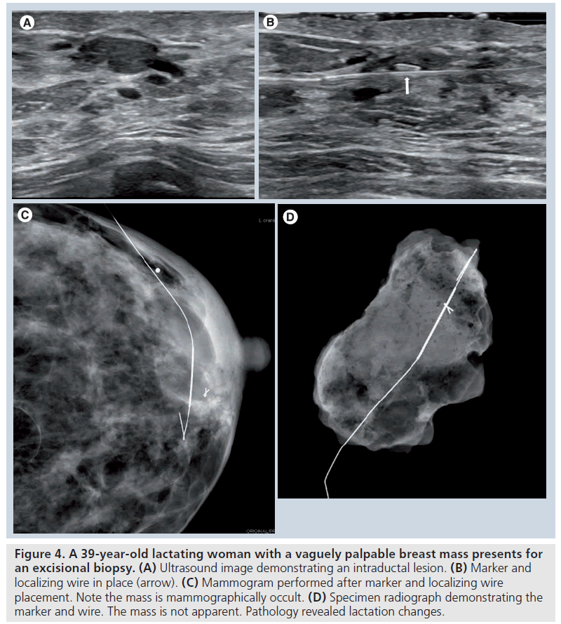 imaging-in-medicine-Ultrasound-image
