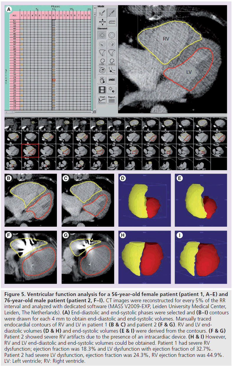 imaging-in-medicine-Ventricular-function