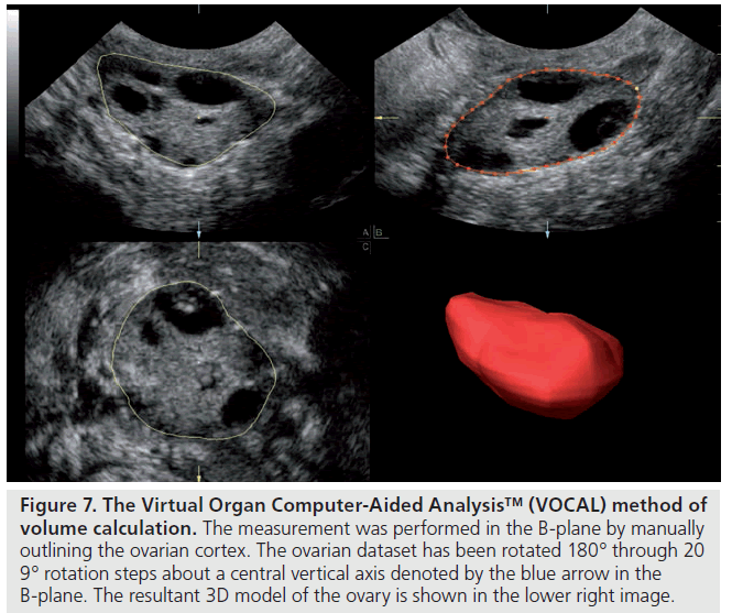 imaging-in-medicine-Virtual-Organ