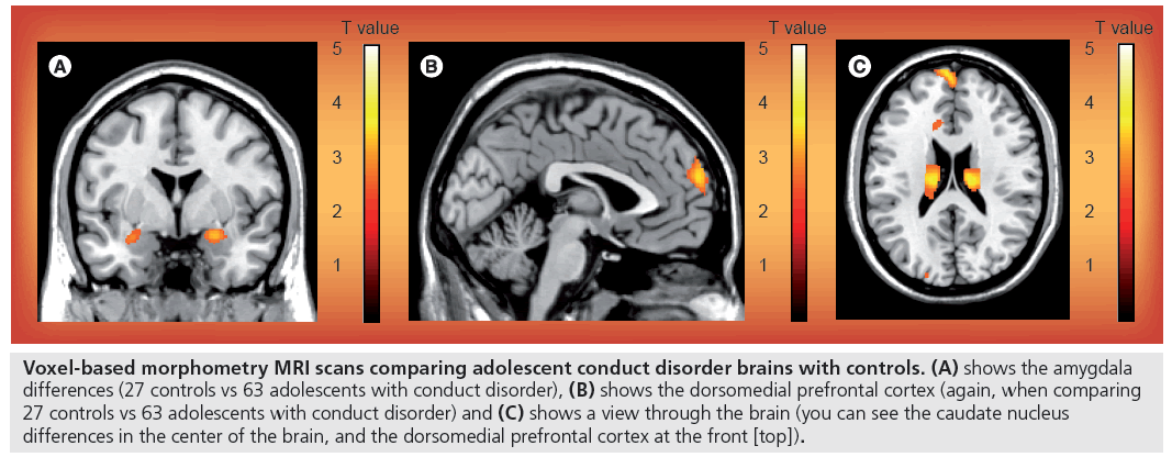imaging-in-medicine-Voxel-based
