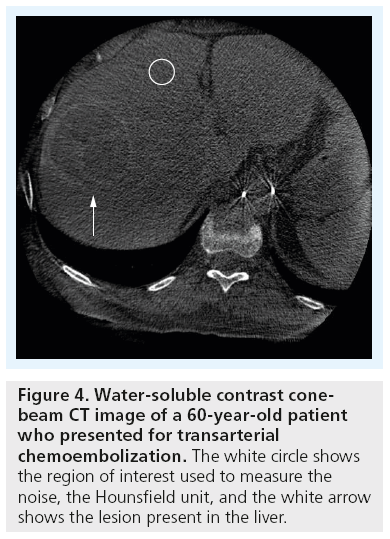 imaging-in-medicine-Water-soluble
