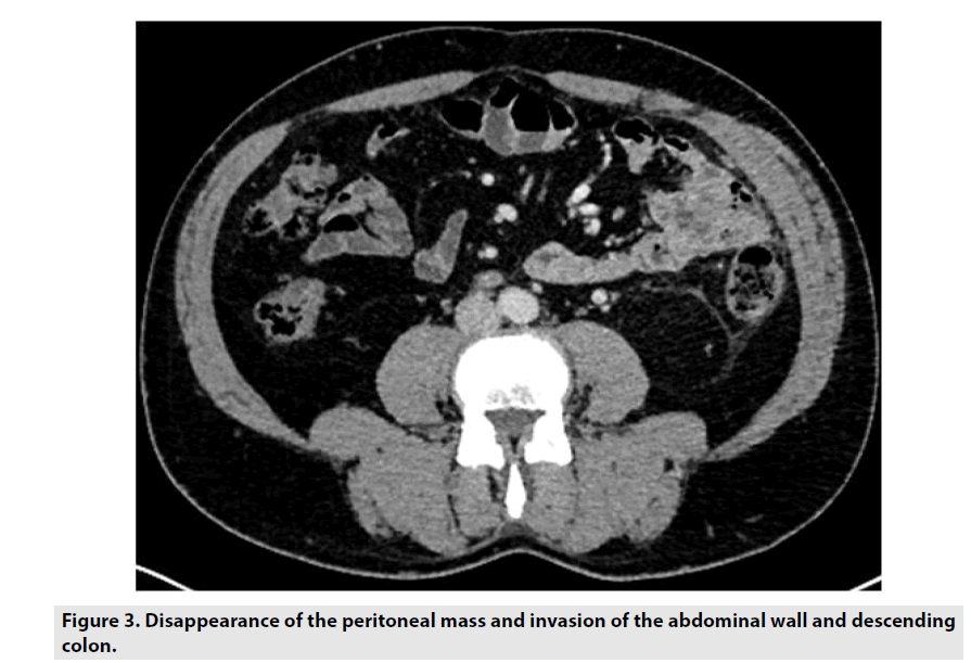 imaging-in-medicine-abdominal-wall