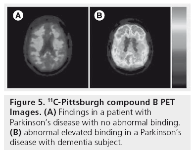 imaging-in-medicine-abnormal-binding