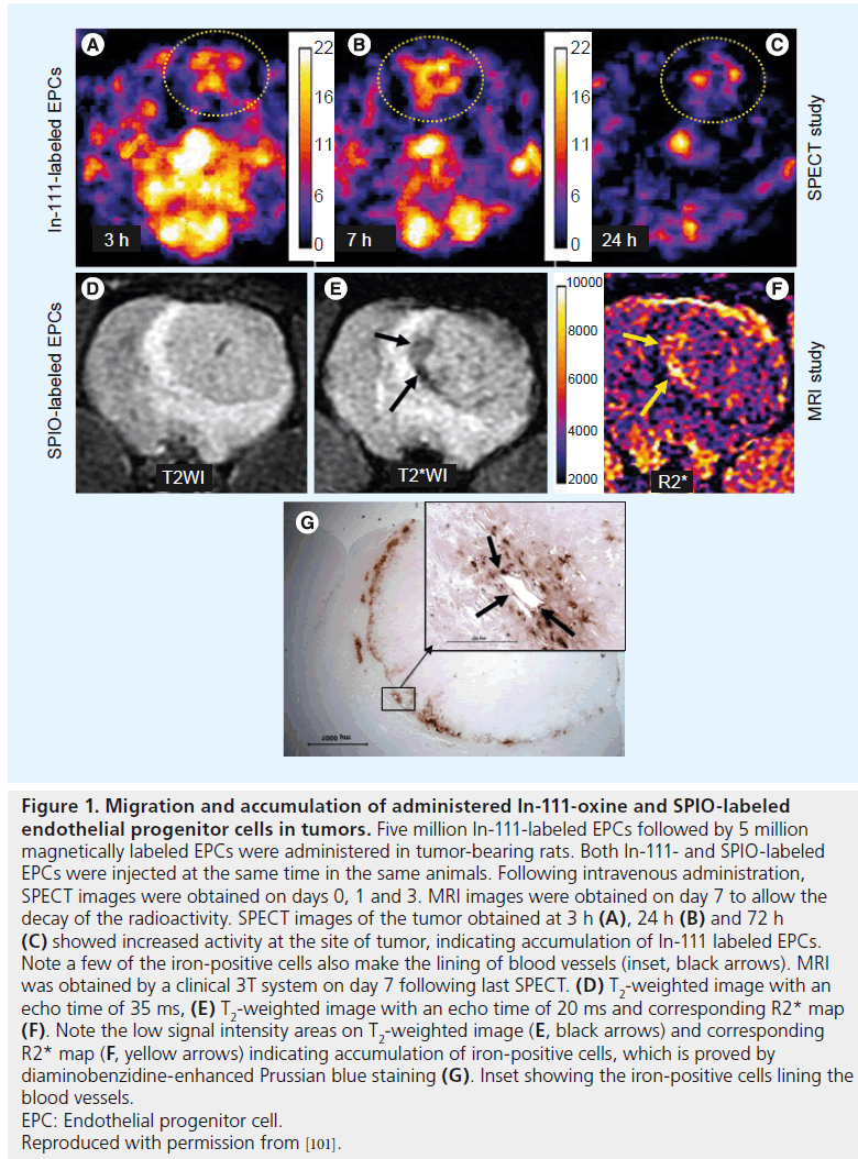 imaging-in-medicine-accumulation-administered