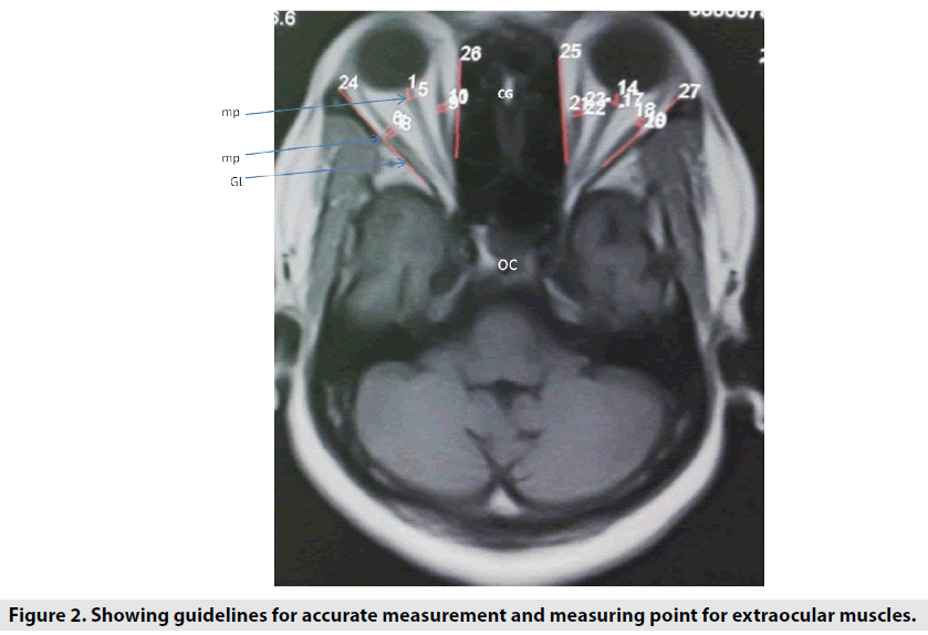 imaging-in-medicine-accurate-measurement