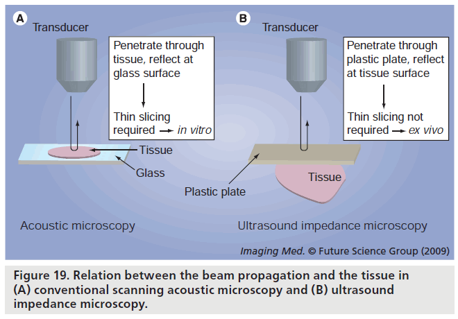 imaging-in-medicine-acoustic-microscopy