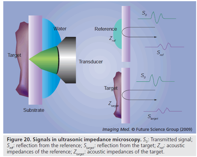 imaging-in-medicine-acoustic-microscopy