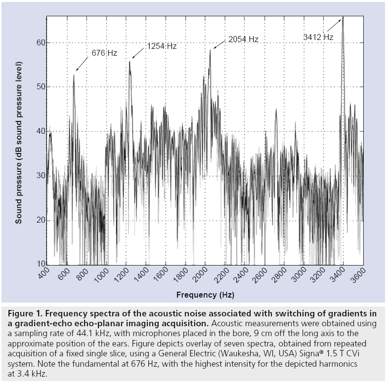 imaging-in-medicine-acoustic-noise