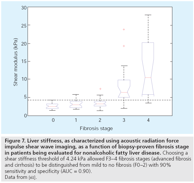 imaging-in-medicine-acoustic-radiation