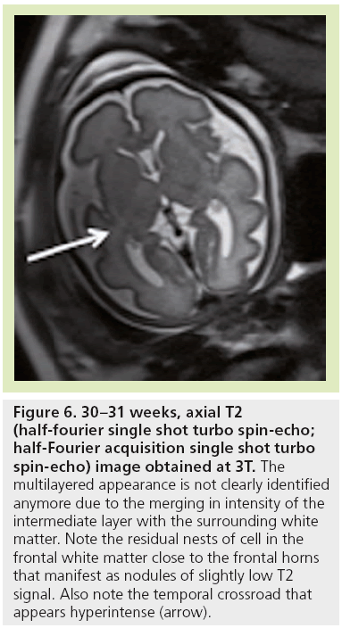 imaging-in-medicine-acquisition