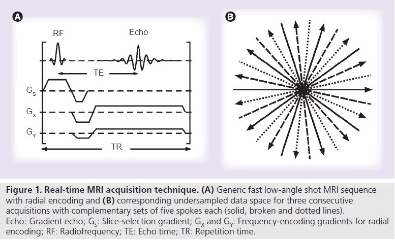 imaging-in-medicine-acquisition-technique