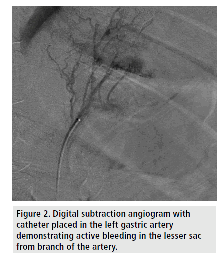 imaging-in-medicine-active-bleeding