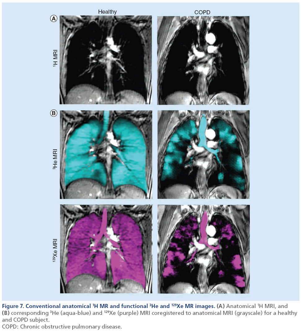 imaging-in-medicine-anatomical-MRI