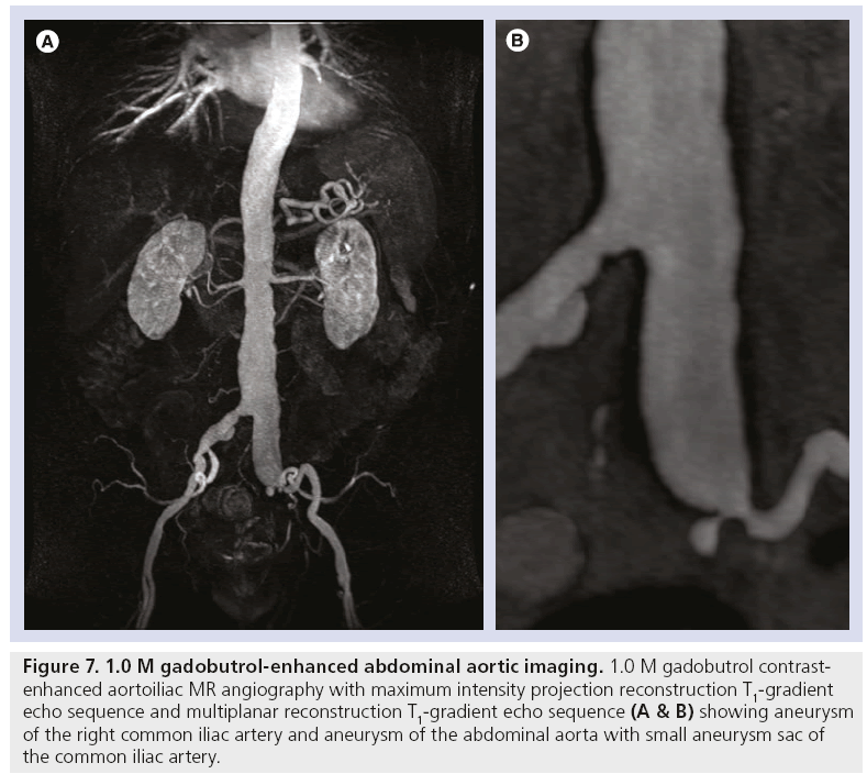 imaging-in-medicine-aortic-imaging