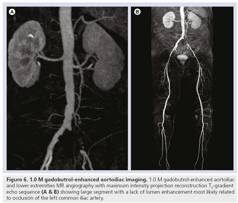 imaging-in-medicine-aortoiliac-imaging