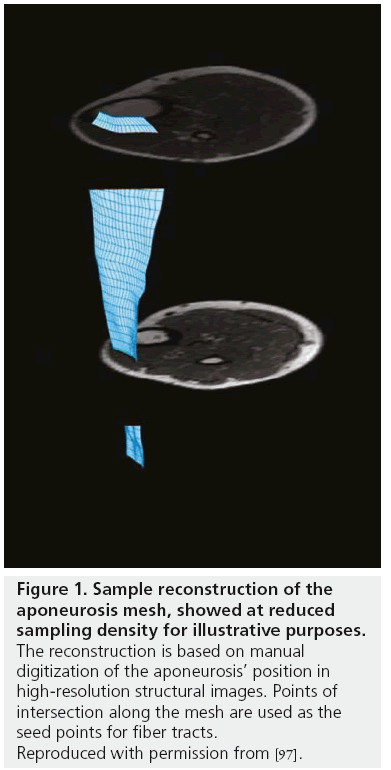 imaging-in-medicine-aponeurosis-mesh