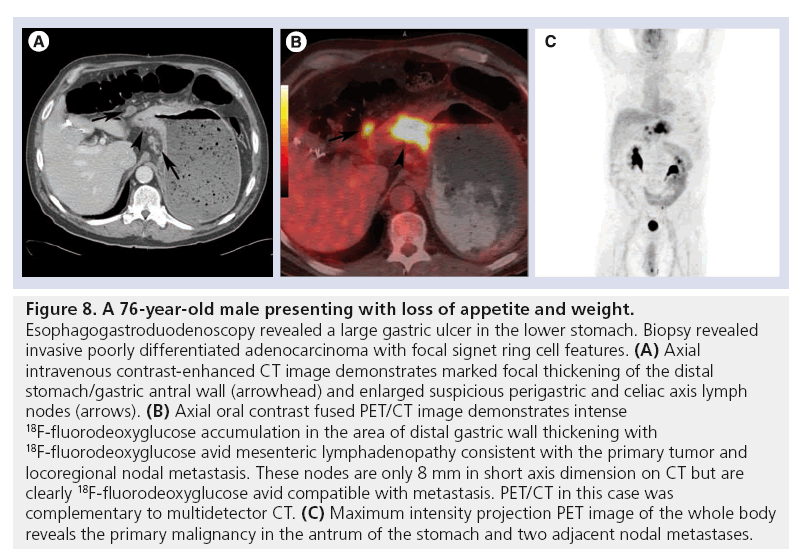 imaging-in-medicine-appetite