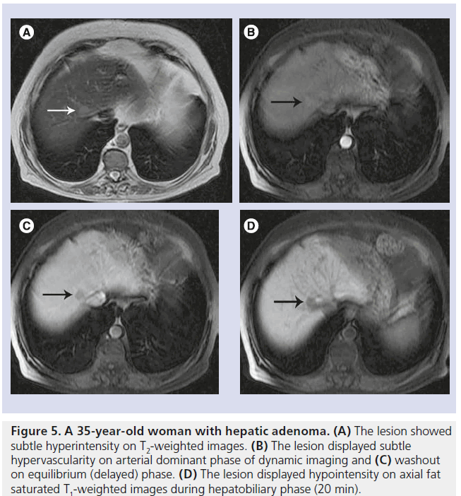 imaging-in-medicine-arterial-dominant
