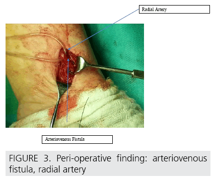 imaging-in-medicine-arteriovenous