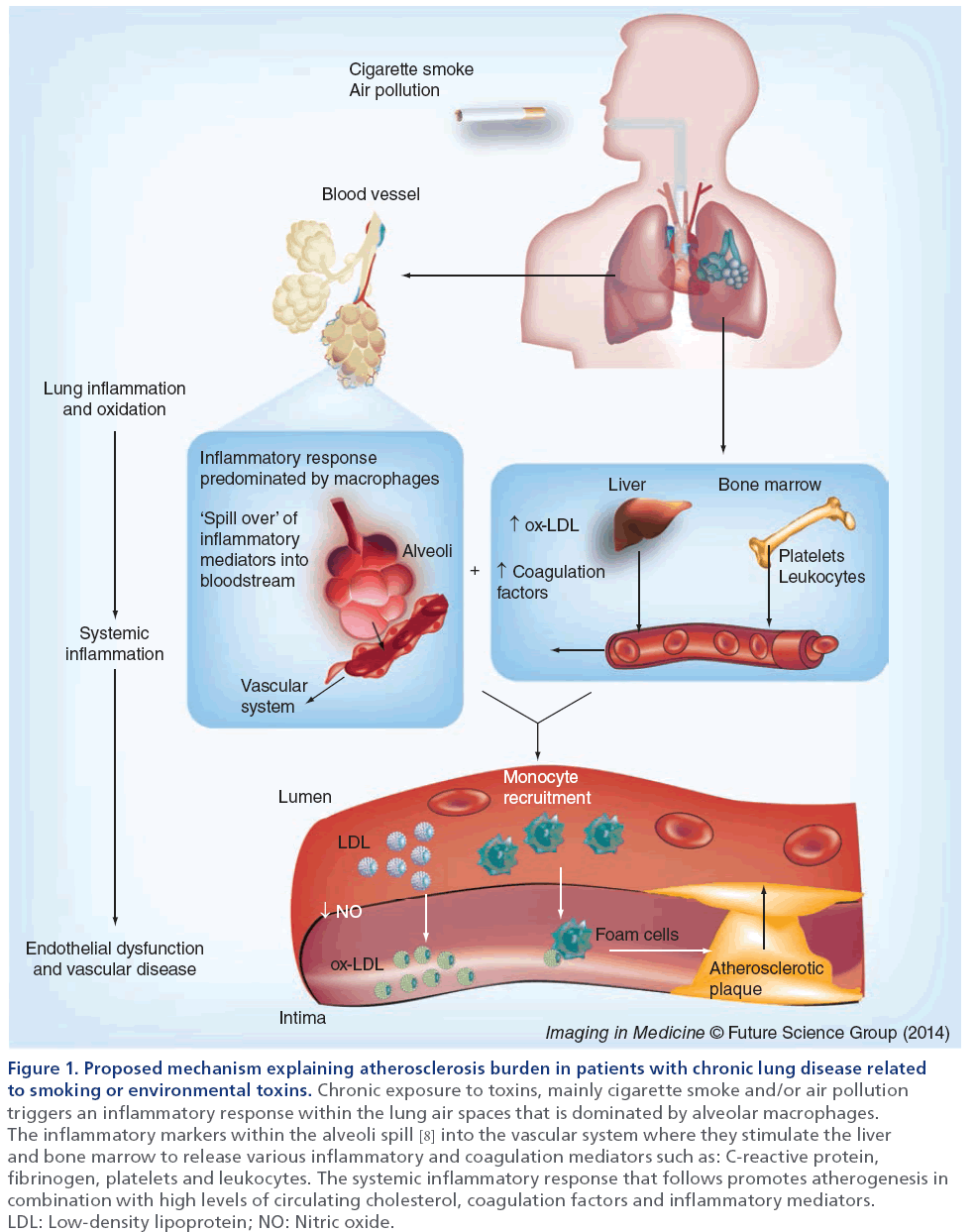 imaging-in-medicine-atherosclerosis