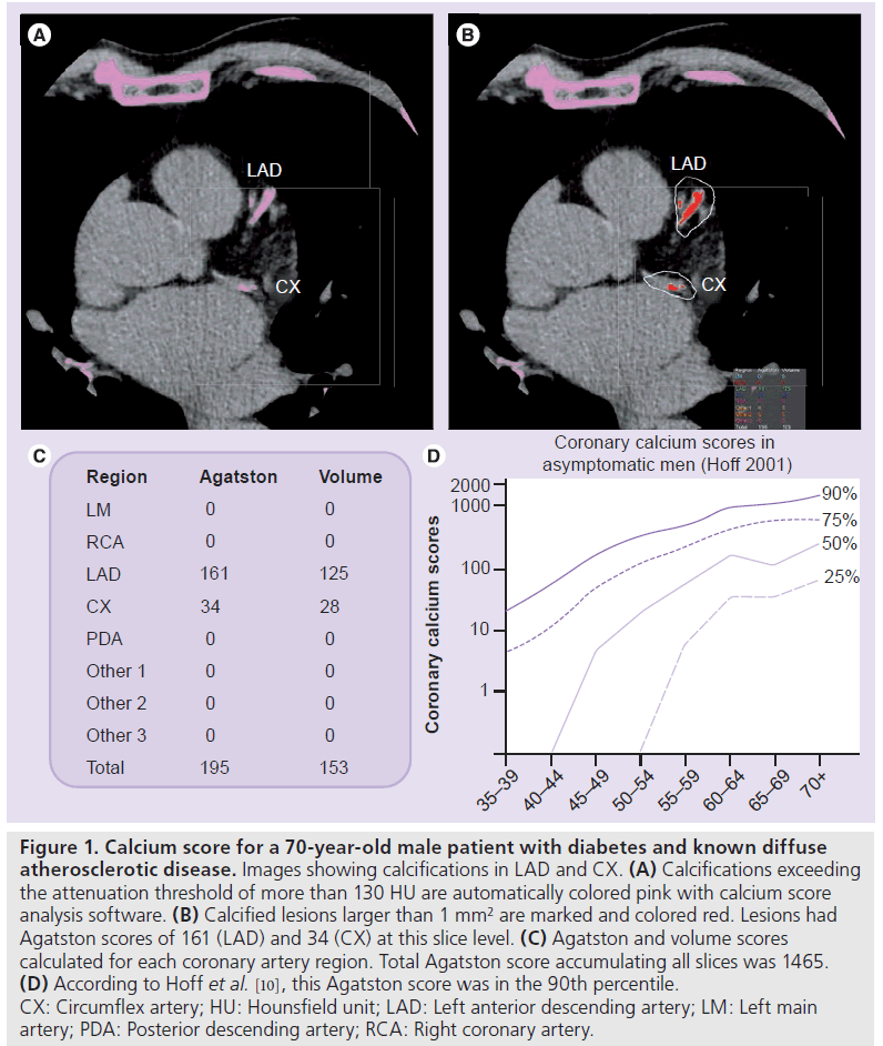 imaging-in-medicine-attenuation-threshold