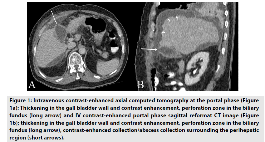 imaging-in-medicine-axial-computed