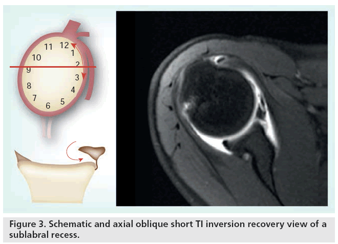 imaging-in-medicine-axial-oblique