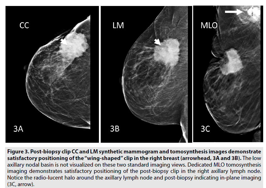 imaging-in-medicine-axillary-lymph