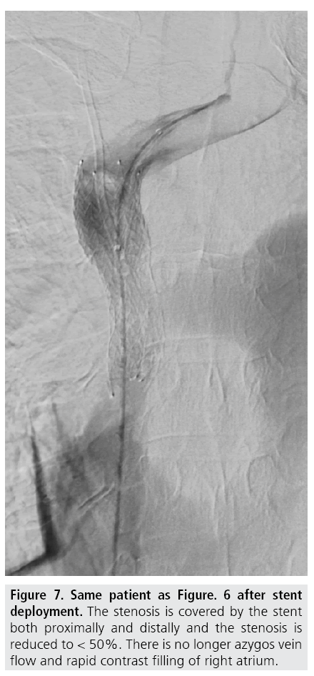 imaging-in-medicine-azygos