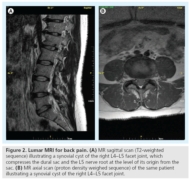imaging-in-medicine-back-pain