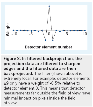 imaging-in-medicine-backprojection