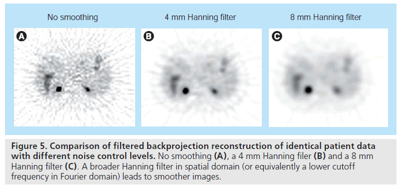 imaging-in-medicine-backprojection-reconstruction