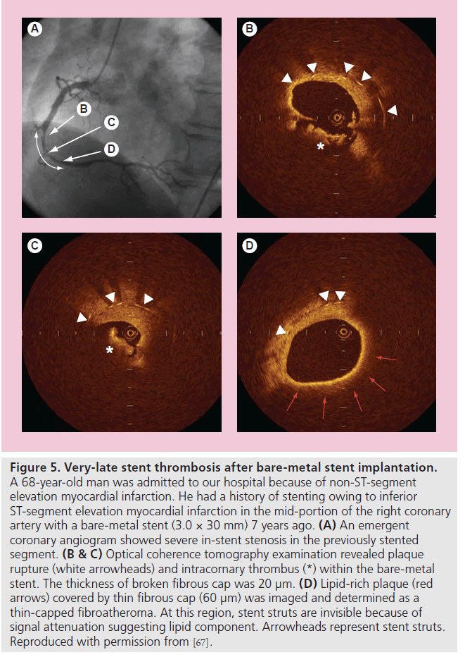 imaging-in-medicine-bare-metal