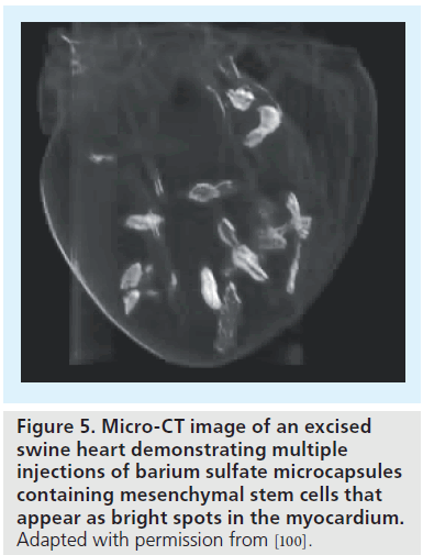 imaging-in-medicine-barium-sulfate