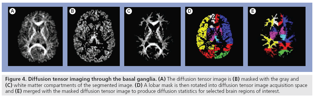 imaging-in-medicine-basal-ganglia
