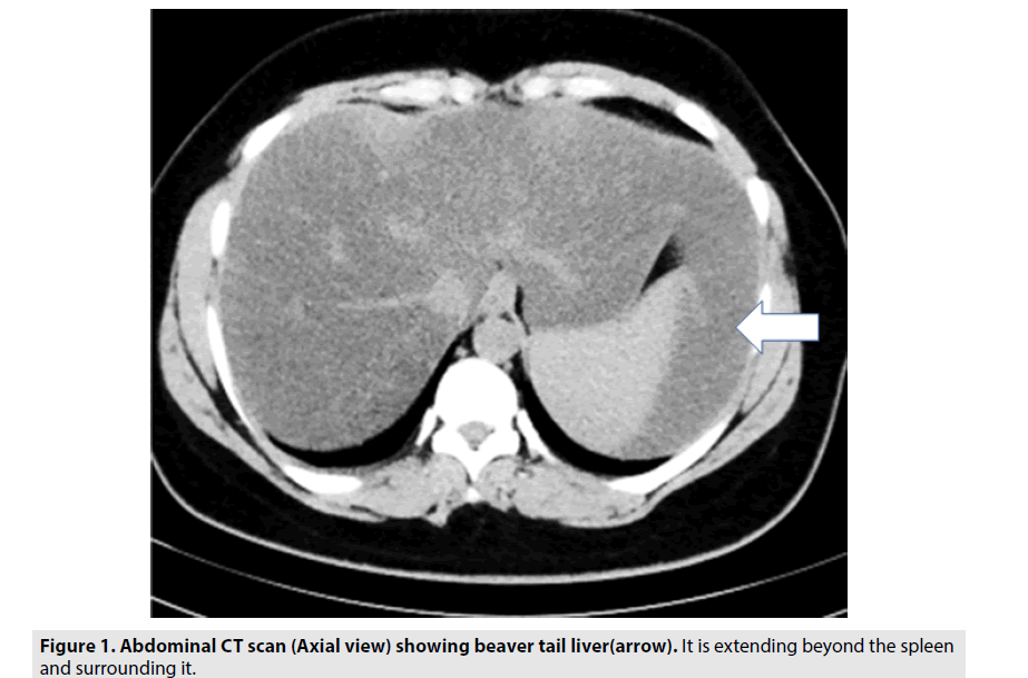 imaging-in-medicine-beaver-tail