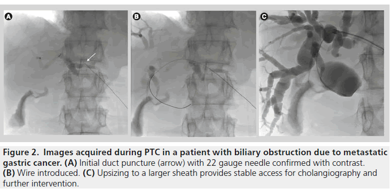 imaging-in-medicine-biliary-obstruction