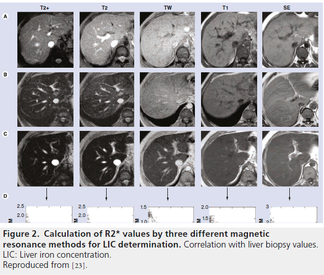 imaging-in-medicine-biopsy-values