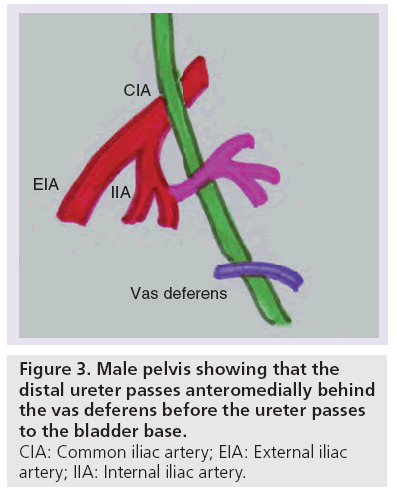 imaging-in-medicine-bladder-base