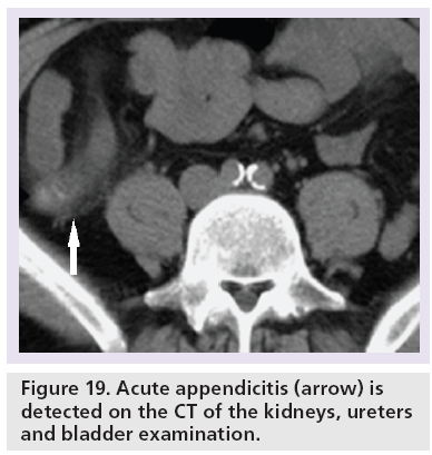 imaging-in-medicine-bladder-examination