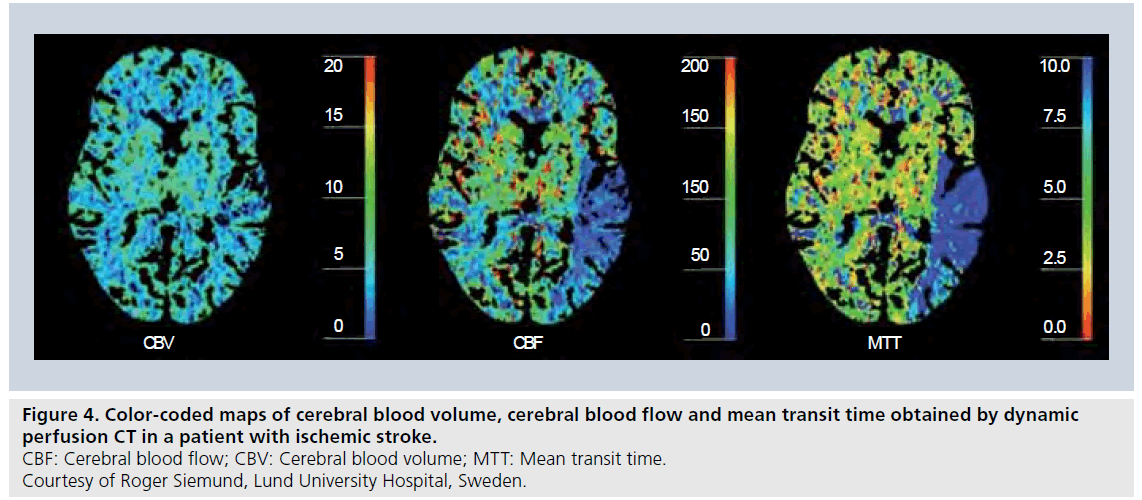 imaging-in-medicine-blood-volume