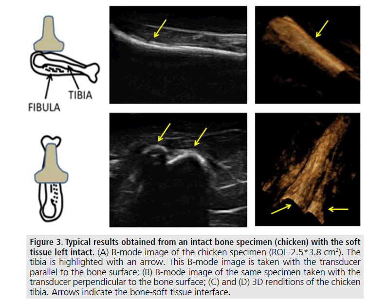 imaging-in-medicine-bone-soft