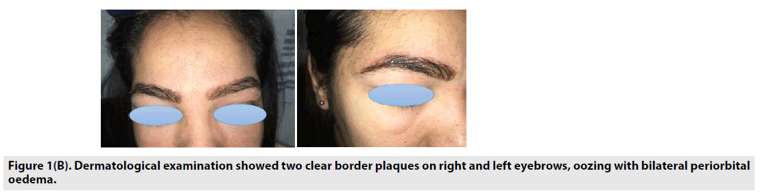 imaging-in-medicine-border-plaques