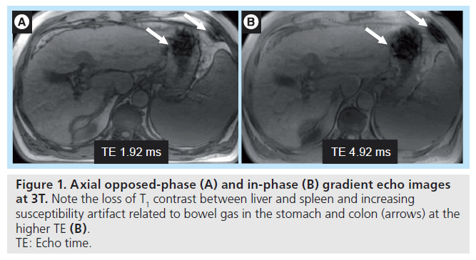imaging-in-medicine-bowel-gas