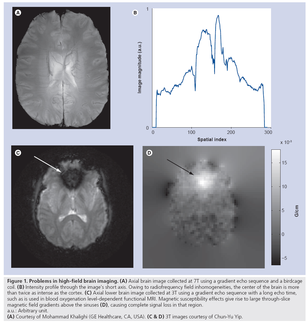 imaging-in-medicine-brain-imaging