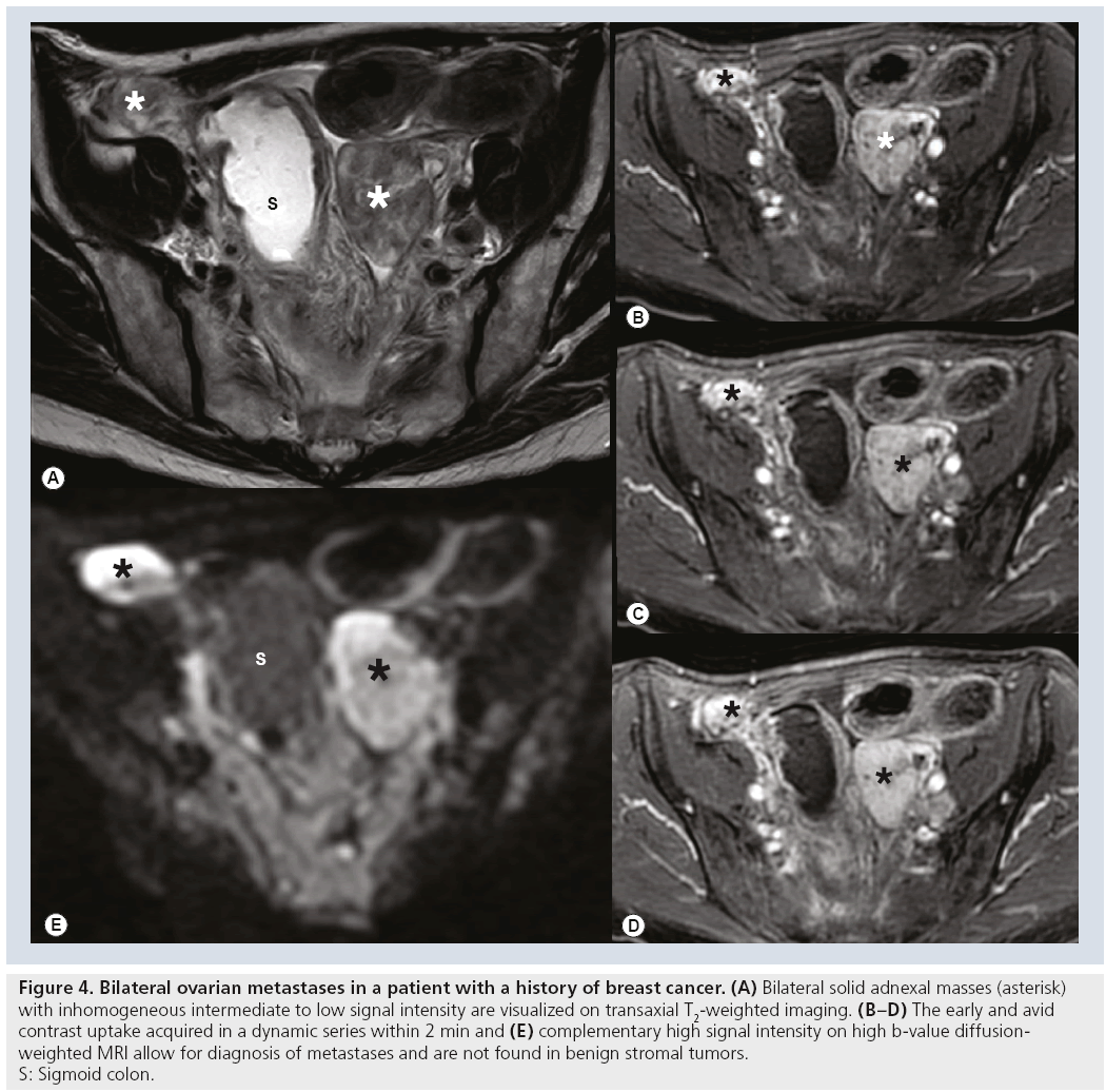 imaging-in-medicine-breast-cancer